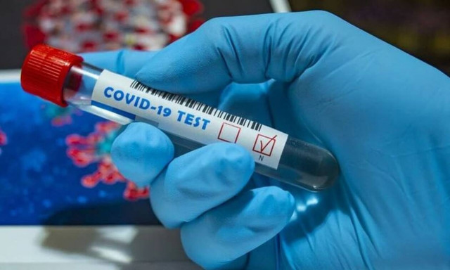 Γνωστό μοντέλο νίκησε τον κορονοϊό έπειτα από 74 ημέρες: Ήταν δύο μήνες «κόλαση»