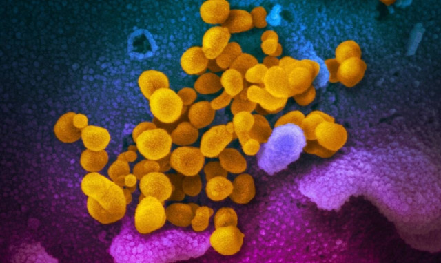 Κορονοϊός: Ερευνητική συνεργασία για τους μοριακούς μηχανισμούς της νόσου και το ανοσολογικό προφίλ