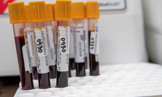 Κορονοϊός: Ποια άτομα είναι μεταδότες υψηλού κινδύνου – Ο ρόλος τους στο δεύτερο κύμα