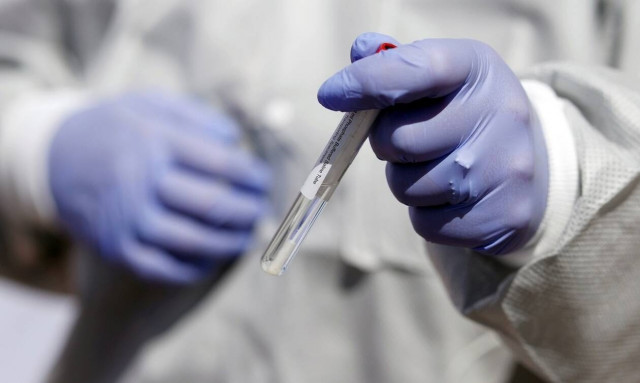 Κορονοϊός: Η παχυσαρκία επιδεινώνει την πορεία της λοίμωξης COVID-19