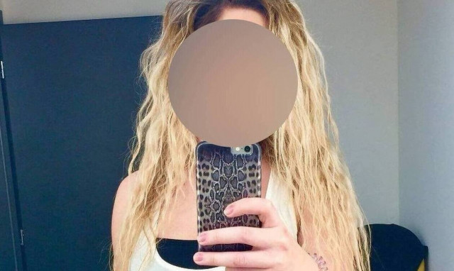 Επίθεση με βιτριόλι: «Μου φάνηκε γνωστή, θα θυμηθώ και θα σας πω», είπε η 34χρονη στις Αρχές