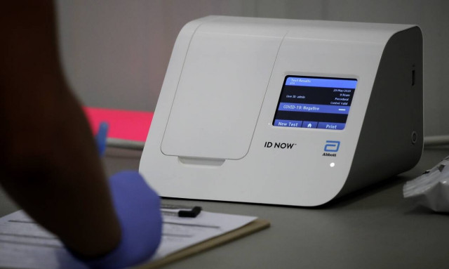 Κορονοϊός: Τεστ αντισωμάτων – Τα πλεονεκτήματα και οι περιορισμοί 