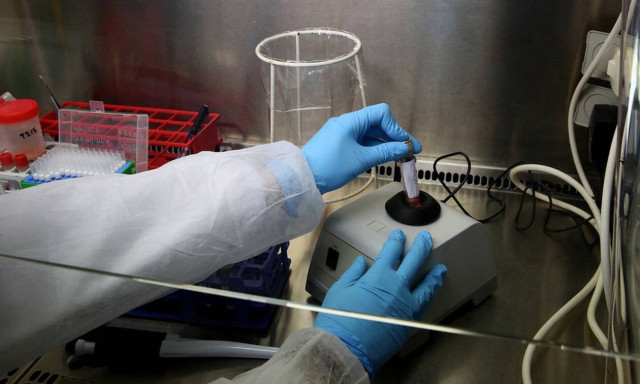 NKUA study on olfactory function of hospitalised patients with COVID-19 disease