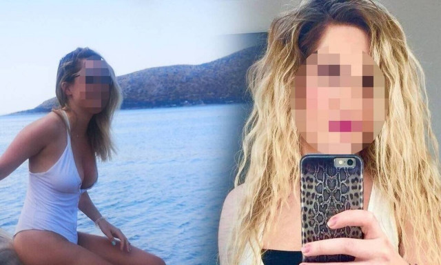 Επίθεση με βιτριόλι: «Είναι καμένο όλο της το πρόσωπο - Δεν είναι σίγουρη αν της επιτέθηκε γυναίκα»