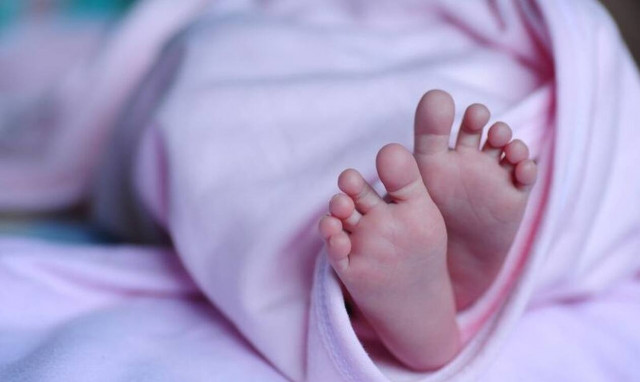 Απίστευτο! Γεννήθηκε μωρό με δυο στόματα - Δείτε τις εικόνες 