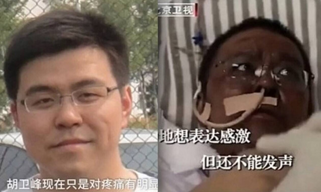 Κορονοϊός: Πέθανε ο γιατρός που «μαύρισε» από τον covid-19