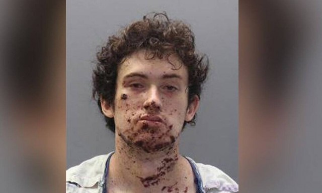 Φρίκη: Ακρωτηριάστηκε ενώ έφτιαχνε βόμβα για να εκδικηθεί (pics)