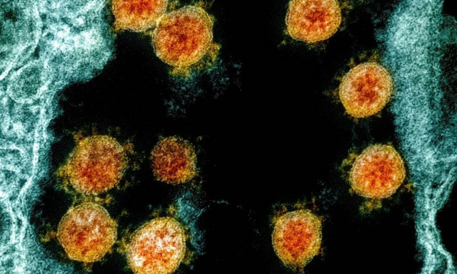 Κορονοϊός: Αλγόριθμοι μοριακών δεδομένων «προβλέπουν» τη σοβαρότητα της νόσου COVID-19 