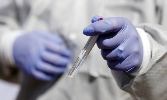 Κορονοϊός: Τι σημαίνει ένα αρνητικό τεστ για τους ασυμπτωματικούς στη νόσο COVID-19