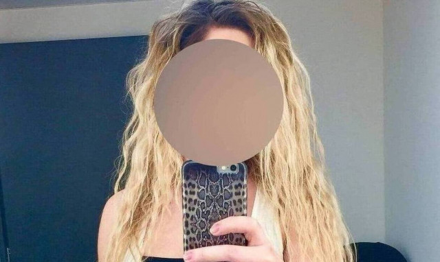 Επίθεση με βιτριόλι - Ιωάννα: Τίποτα δεν μπορεί να απαλύνει τον πόνο που ζω