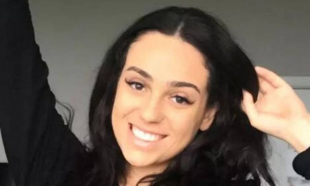 Δείτε πώς έγινε το πρόσωπό της μετά από αποτυχημένη πλαστική (pics)