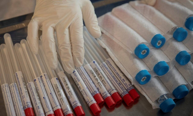 Κορονοϊός: Δωρεάν εξέταση αντισωμάτων COVID-19 για τα Σώματα Ασφαλείας σε Αττική και Θεσσαλονίκη 