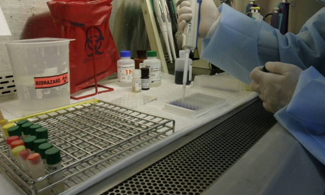 HIV: Ενδείξεις ότι ασθενής θεραπεύτηκε μόνο με «κοκτέιλ» φαρμάκων