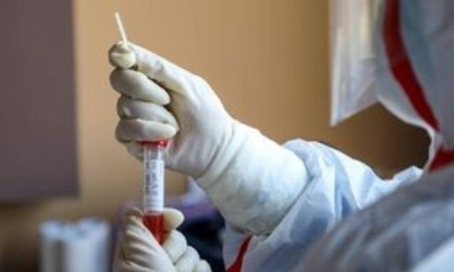 Κορονοϊός: Συναγερμός στην Αλβανία - Ραγδαία αύξηση κρουσμάτων