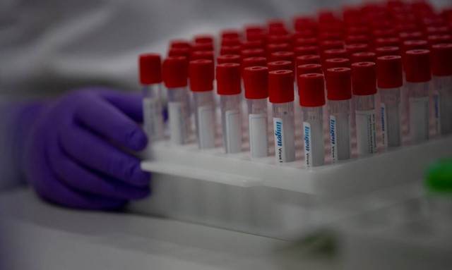 Κορονοϊός: Για πρώτη φορά, ένα εκατομμύριο κρούσματα σε 100 ώρες σε όλο τον κόσμο