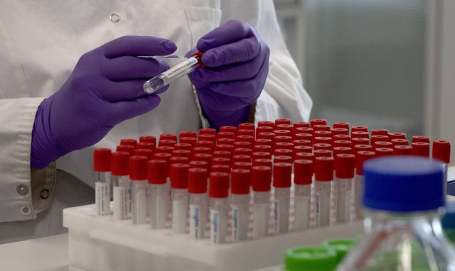 Κορονοϊός - Ο ΠΟΥ προειδοποιεί: Μην περιμένετε το εμβόλιο πριν από το 2021