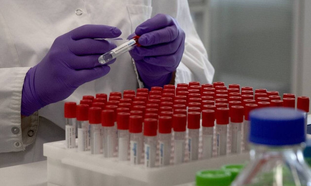 Ρωσία: Οι Ρώσοι θα έχουν έως το τέλος του χρόνου το εμβόλιο του κορονοϊού