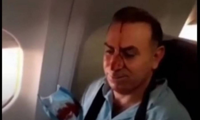 Τρόμος στον αέρα: Αμερικανικό μαχητικό «παρενόχλησε» ιρανικό αεροπλάνο - Τραυματίστηκαν επιβάτες