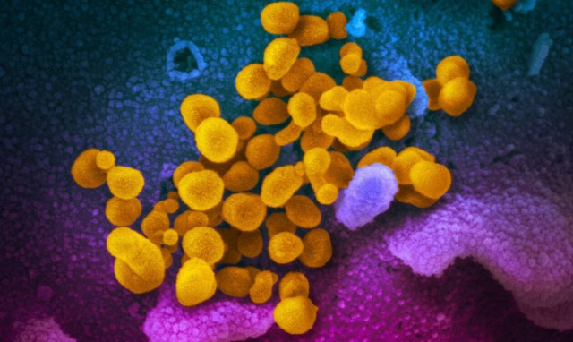 Κορονοϊός: Μεταλλαγμένο γονίδιο παίζει ρόλο στη σοβαρή νόσο COVID-19