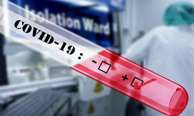 Κορονοϊός: 3,5 φορές μεγαλύτερος ο κίνδυνος μόλυνσης για το ιατρονοσηλευτικό προσωπικό