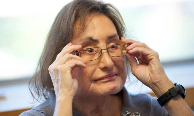 Πέθανε η πρώτη Αμερικανίδα που είχε υποβληθεί σε μεταμόσχευση προσώπου