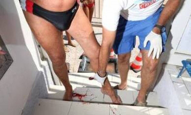 Το μπάνιο από την κόλαση: Έβγαιναν αιμόφυρτοι από τη θάλασσα οι λουόμενοι (pics)