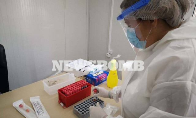 Κορονοϊός -Δερμιτζάκης: Στατιστικό λάθος η μείωση κρουσμάτων των προηγούμενων ημερών