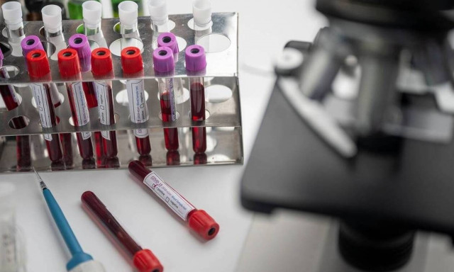 Κορονοϊός: Γιατί περιπτώσεις επαναμόλυνσης ανησυχούν τους ειδικούς 