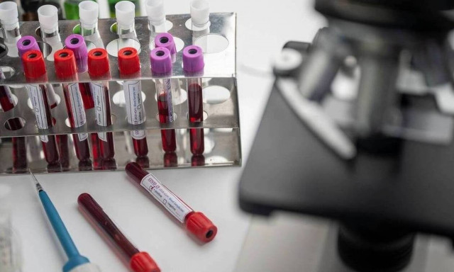 ΗΠΑ - κορονοϊός: H FDA είναι προετοιμασμένη για την ταχεία έγκριση ενός εμβολίου