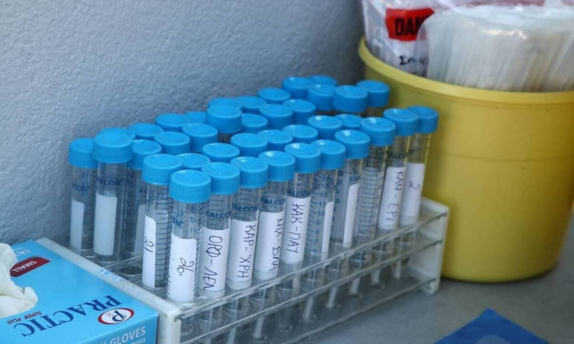 ΒΙΑΝΕΞ και Όμιλος DPG: Δωρεάν Τεστ COVID-19 για όλους τους εργαζομένους των εταιρειών