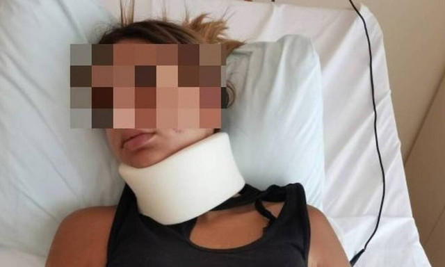 Ξυλοδαρμός 13χρονης στη Λαμία: Έχει τραύματα σε όλο το σώμα - Τα υποτιμητικά σχόλια στο Facebook