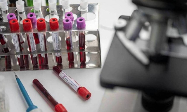 Κορονοϊός - Βρετανική μελέτη! Η υδροκορτιζόνη μειώνει τη θνητότητα των ασθενών με Covid-19