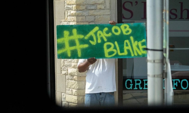 ΗΠΑ: «Πονάω 24 ώρες το 24ωρο» - Συγκλονίζει ο 29χρονος που δέχτηκε αστυνομικά πυρά