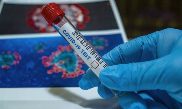 Κορονοϊός - Γρεβενά: Θετικά βρέθηκαν τρία νεαρά άτομα που συμμετείχαν σε πάρτι