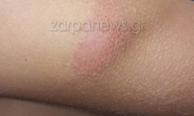 Κορονοϊός - Χανιά: Μαθητές τραυματίστηκαν σε λεωφορείο του ΚΤΕΛ στα Χανιά ...λόγω μάσκας