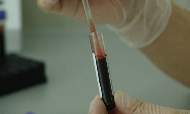 Τεστ αντισωμάτων κορονοϊού: Καλύτερα αποτελέσματα 20 μέρες από τα πρώτα συμπτώματα