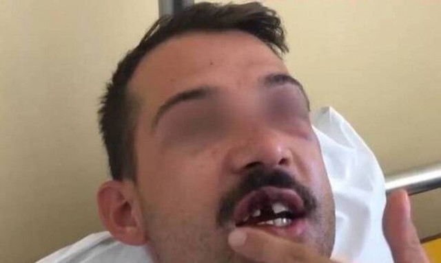 Εφιάλτης για 33χρονο στο Γκάζι: Τον παραμόρφωσαν από το ξύλο για ένα κινητό