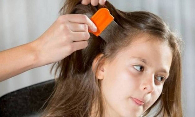 Νεκρή 12χρονη από ψείρες - Συνελήφθησαν οι γονείς