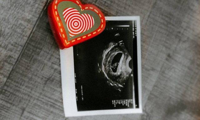 Τι να κάνει μια γυναίκα μετά την εξωσωματική;