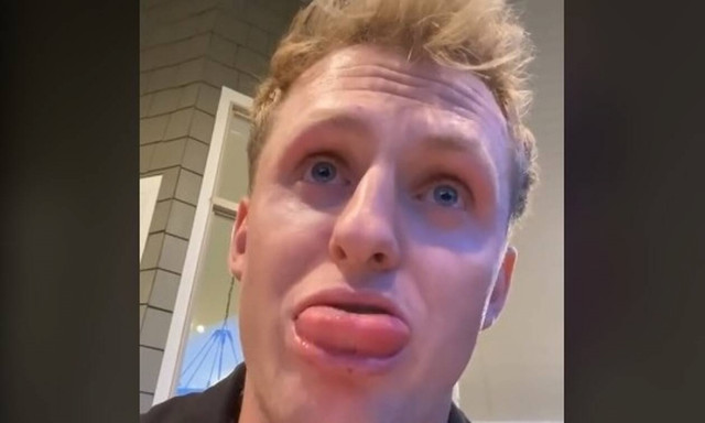 «Ας με βοηθήσει κάποιος!» - Η έκκληση του ανθρώπου που τον τσίμπησε μέλισσα στη γλώσσα! (vid)