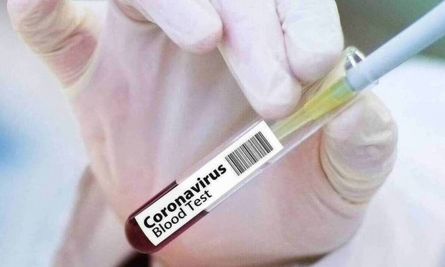 Κορονοϊός: Έρχεται το νέο τεστ-εξπρές που ανιχνεύει τον ιό σε μόλις πέντε λεπτά