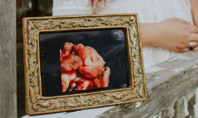 Τι ακούει ένα έμβρυο;