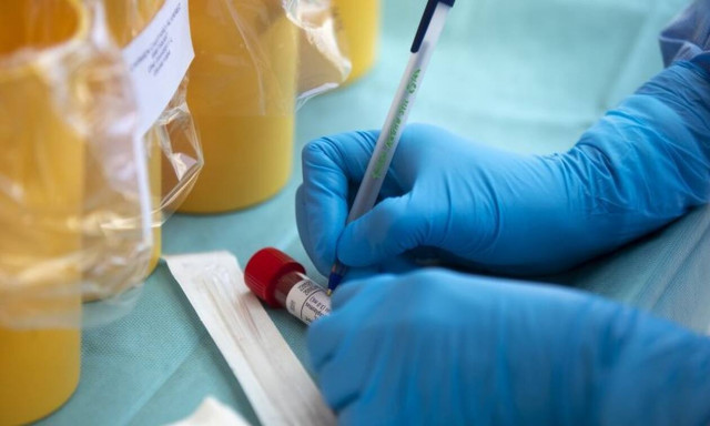 Εφιαλτική διαπίστωση: Ο κορονοϊός ζει σε συσκευασία κατεψυγμένων τροφίμων