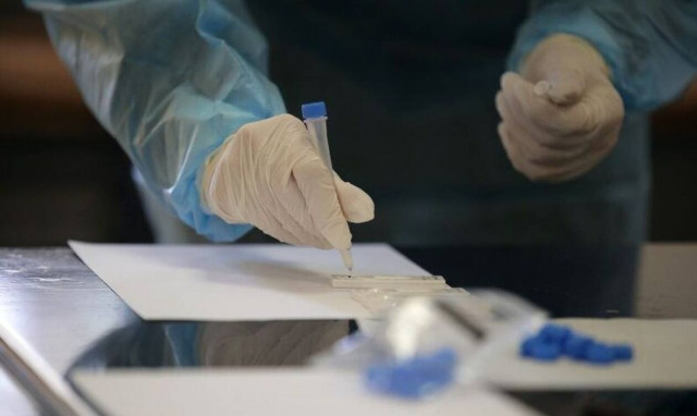 Κορονοϊός: Τρεις νέοι θάνατοι στην Ελλάδα τις τελευταίες ώρες