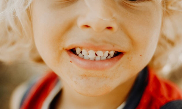 Από ποια ηλικία τα παιδιά πρέπει να λαμβάνουν φθόριο;