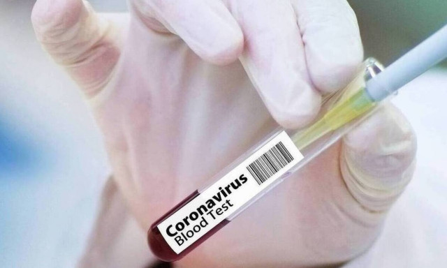 Κορονοϊός Εμβόλιο: Τι είναι η «Αποστολή του Αιώνα» που ετοιμάζουν οι αεροπορικές