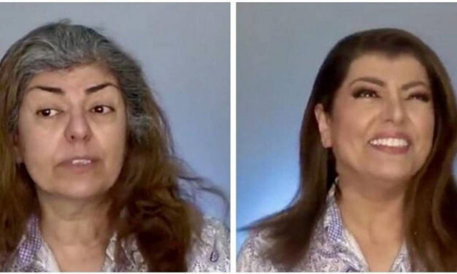 Την έλεγαν «κακάσχημη» και εκείνη μεταμορφώθηκε σε κούκλα