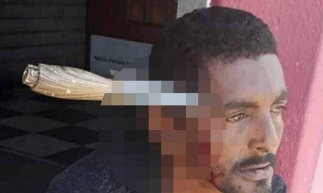 Του κάρφωσαν μαχαίρι στο κεφάλι και εκείνος πήγε για δουλειά - Σκληρές εικόνες