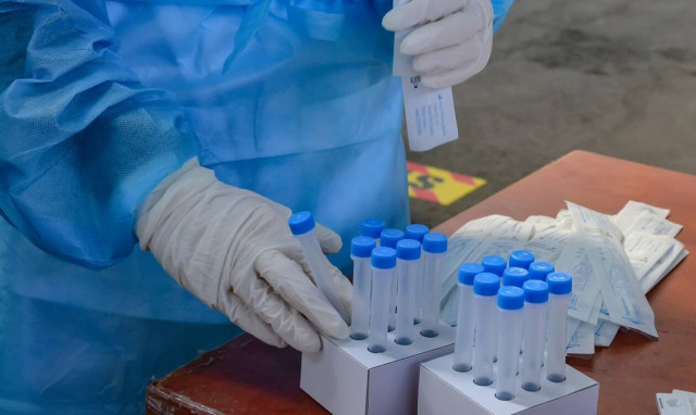 Κορονοϊός: Ιδιωτικά εργαστήρια σταματούν τα Covid test λόγω διατίμησης