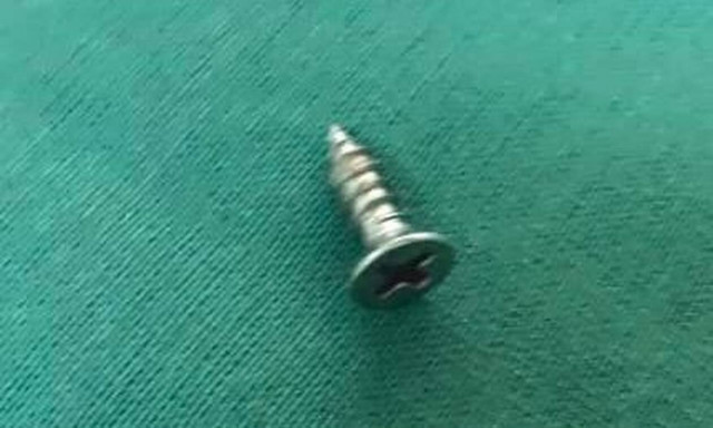 Κρήτη: 3χρονο κοριτσάκι κατάπιε βίδα - Σοκάρουν οι ακτινογραφίες